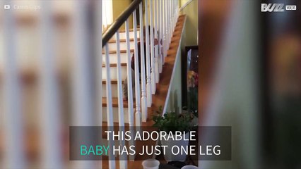 Μωράκι με αναπηρία ανεβαίνει τις σκάλες για πρώτη φορά