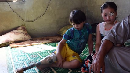 'Oğlum uyuyunca kesik bacağına bakıp ağlıyorum' (2) - İDLİB