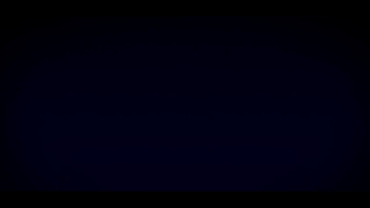 Alper Öztürk'ün Saç Ekimi sürecinde yaşadıkları