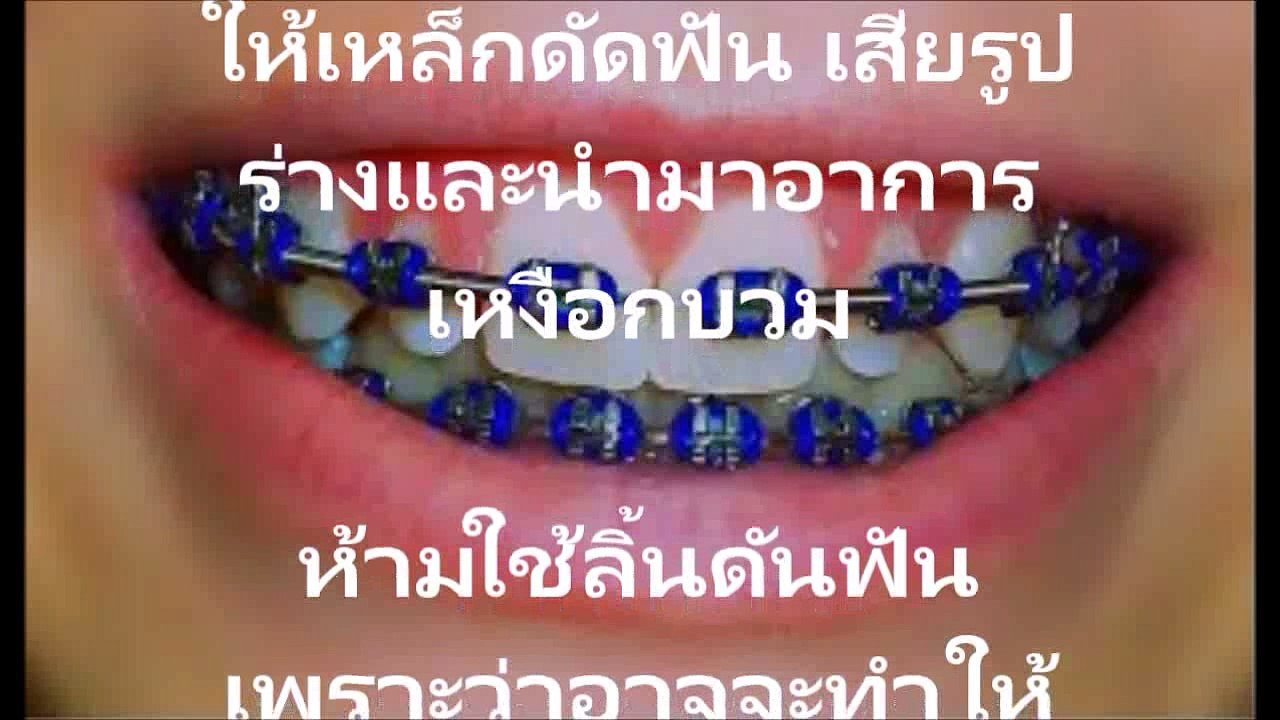ข้อห้ามที่ไม่ควรกระทำหลังจัดฟัน ถ้าไม่อยากให้เหล็กของคุณหลุด ห้ามทำโดยเด็ดขาดควรระวังสำหรับผู้จัดฟันใหม่ข้อห้ามสำหรับคนจัดฟัน