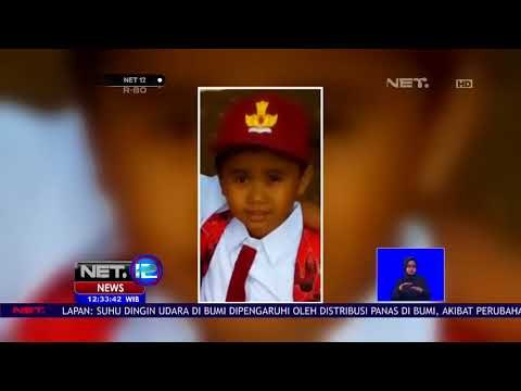 Kondisi Terkini Arya Bocah Asal Bandung Yang Mengidap Menyakit Langka-NET12