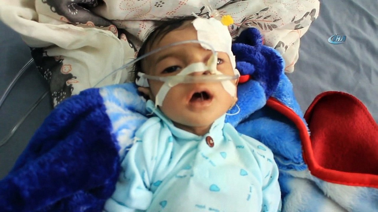 - UNICEF’ten Yemen’de Yetersiz Beslenme Sorunu Yaşayan Çocuklara Yardım