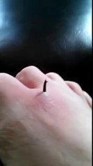 Elle se retire une "petite" épine du pied... Enfin, pas si petite que ça