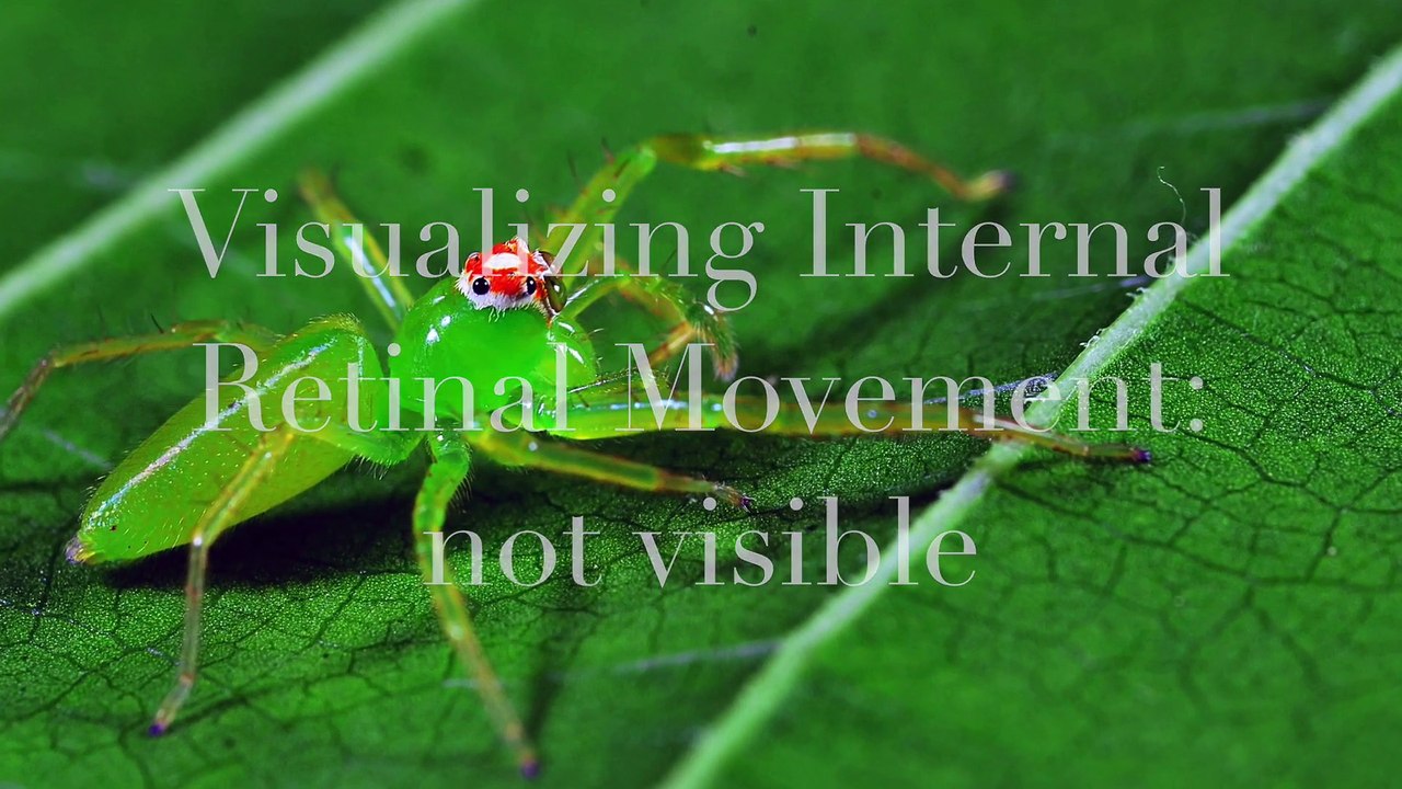 Visualizing Internal Retinal Movement in Lyssomanes viridis jumping spider