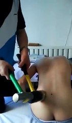 Ce kiné a une technique un peu extreme pour remettre le dos en place... Coup de marteau