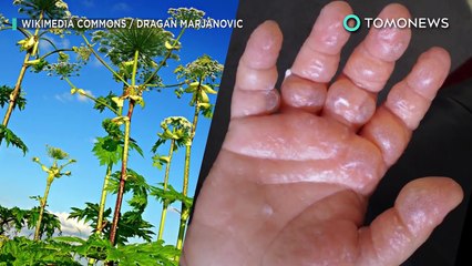 Fish spa: Woman's toenails fall off after fish pedicure - TomoNews