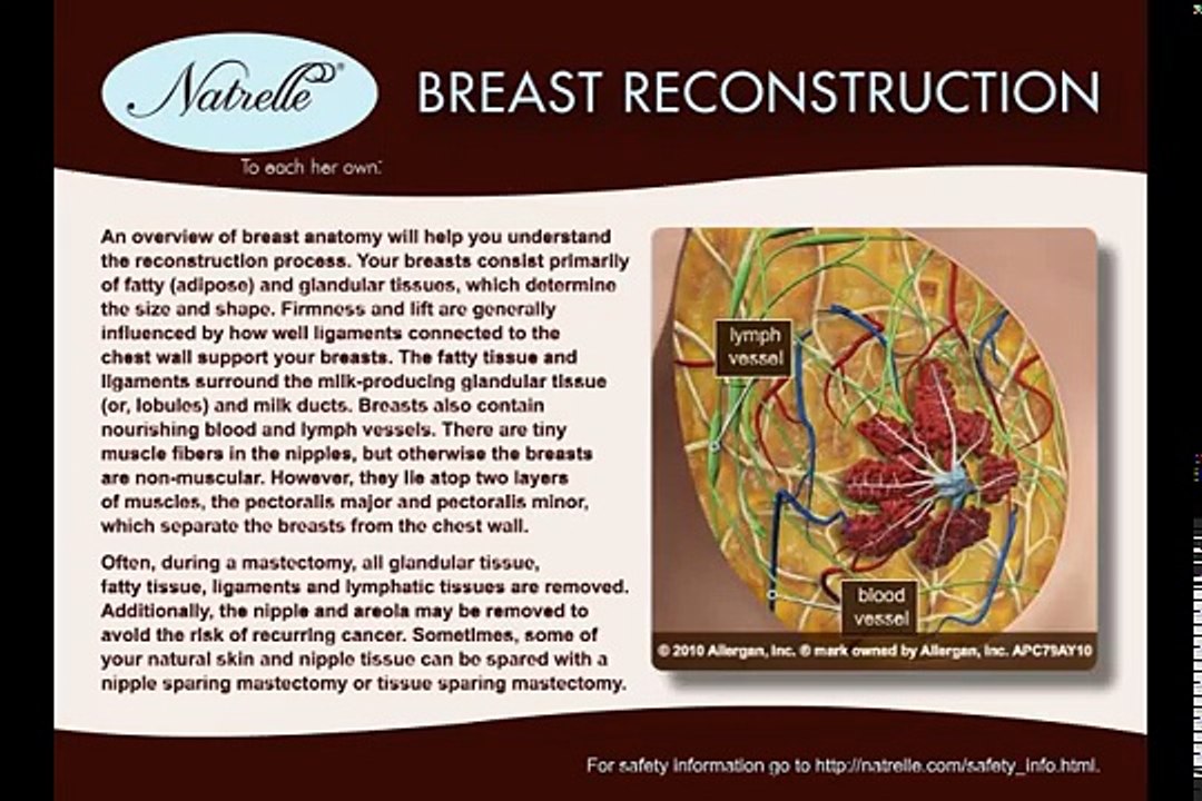 Breast Reconstruction Video - Dr James Southwel...