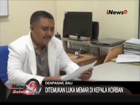 Tim Forensik Yakin Angeline Tewas Dibunuh Setelah Menemukan Luka Memar Di Kepala - iNews Malam 10/06