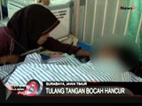 Petasan Meledak, Tangan Bocah Ini Hancur, Madura - iNews Pagi 03/07