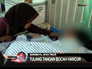 Petasan Meledak, Tangan Bocah Ini Hancur, Madura - iNews Pagi 03/07