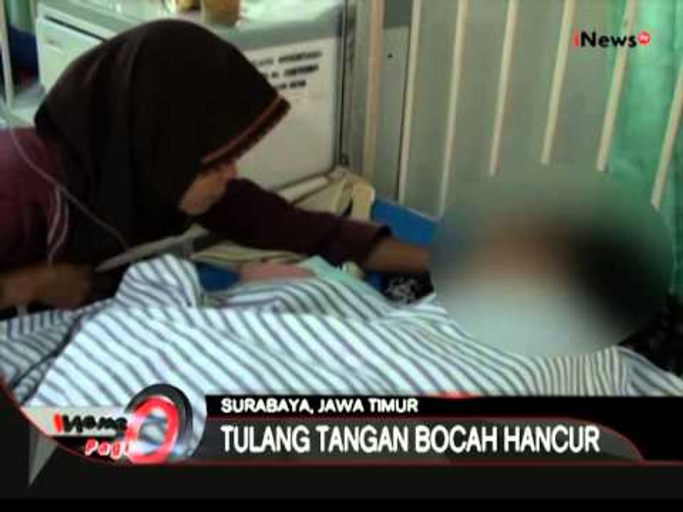 Petasan Meledak, Tangan Bocah Ini Hancur, Madura - iNews Pagi 03/07