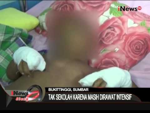 Bocah SD Jadi Korban Ledakan Petasan - iNews Siang 27/07