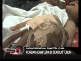 Ajaib! Korban Longsor Sumatra Utara Selamat, 10 Jam Tertimbun Longsor - iNews Pagi 29/07