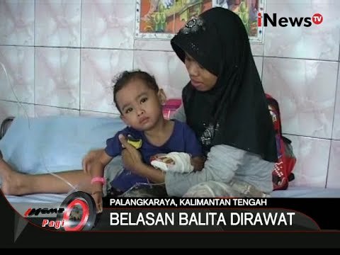 Dampak Kabut Asap, Belasan Balita Dirawat Dan Bayi Berusia 28 Hari Meninggal - iNews Pagi 08/10