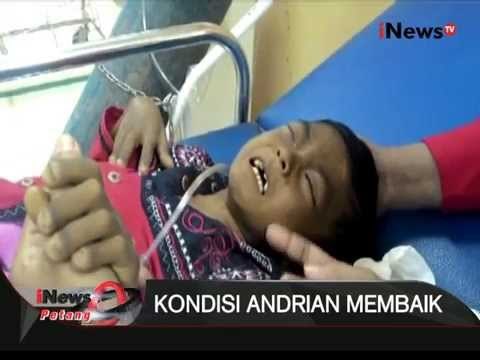 Kondisi Adrian Balita Penderita Hepatitis Dan Gizi Buruk Mulai Membaik - iNews Petang 27/11