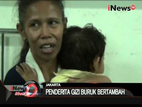 Miris, Masih Ada Penderita Gizi Buruk Di Ibu Kota - iNews Siang 12/11
