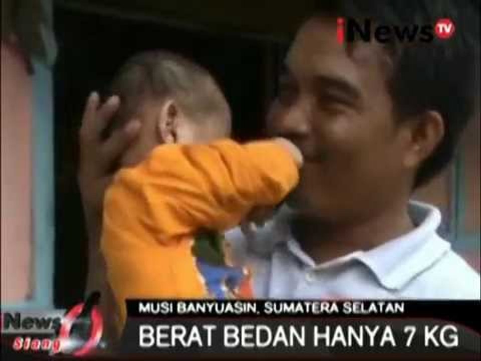 Inilah Anak-Anak Yang Menderita GIzi Buruk Selam 8 Tahun - iNews Siang 18/11