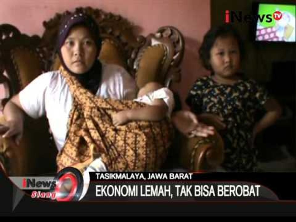 Bocah Penderita Bocor Ginjal, Seluruh Tubuh Membengkak - iNews Siang 01/12