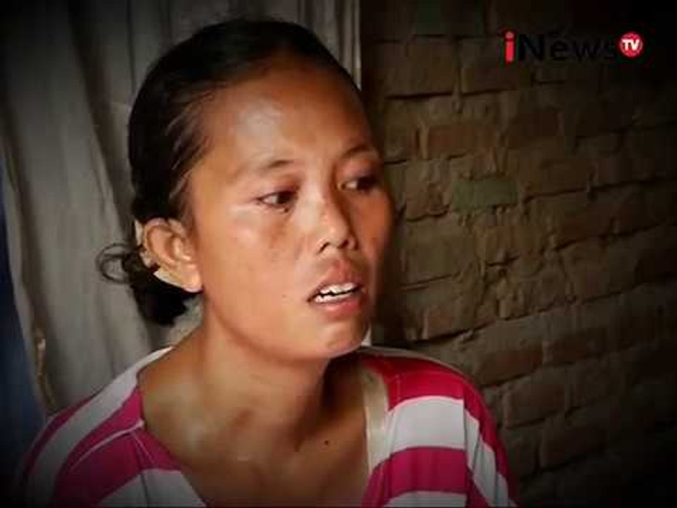 Potret Kemiskinan, Alif Penderita Benjolan Selaput Otak - iNews Siang 29/12