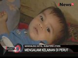 Seorang balita di Mandailing Natal lahir dengan usus keluar dari perut - iNews Siang 19/01