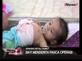 Tak miliki biaya operasi, usus bayi dibiarkan terburai di Gunung Sitoli, Sumut - iNews Siang 04/02