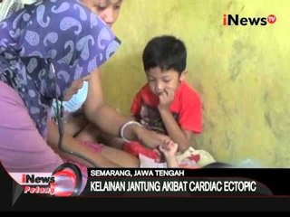 Kelainan paru-paru, seorang bayi berumur 4 bulan di Semarang memprihatinkan - -iNews Petang 11/03