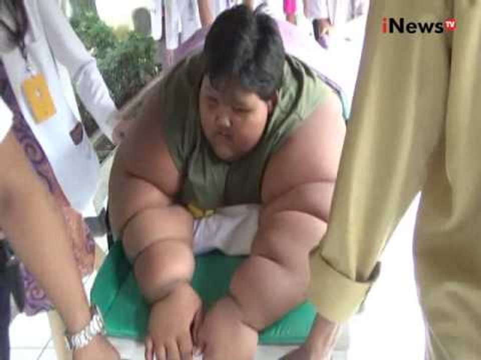 Bocah penderita obesitas asal Karawang akan dirawat di RS Hasan Sadikin, Bandung - iNews Siang 12/07