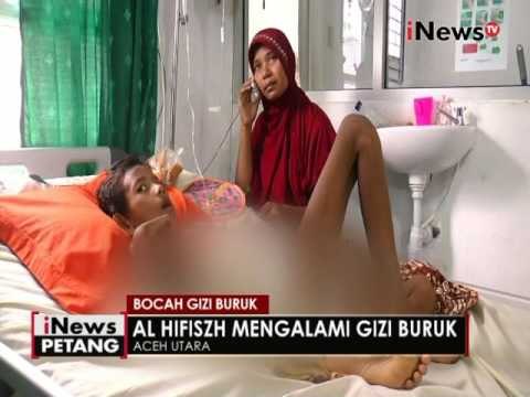 Bocah gizi buruk masih dirawat di Rumah sakit - iNews Petang 14/07