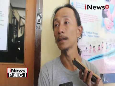 Bayi berkepala dua lahir dengan kondisi sehat - iNews Pagi 10/08