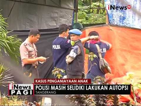 Polisi masih selidiki kasus penganiayaan anak oleh orang tuanya - iNews Pagi 25/10