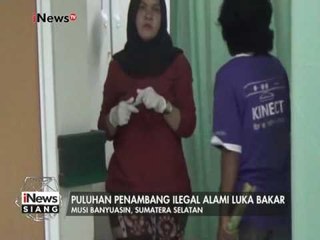 Puluhan Penambang Ilegal alami luka bakar karena sumur meledak - iNews Siang 12/01