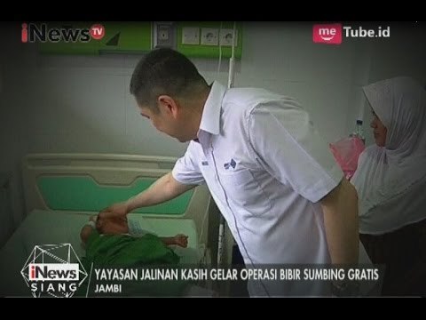 MNC Group Melalui Yayasan Jalinan Kasih Mengadakan Operasi Bibir Sumbing Gratis - iNews Siang 16/05