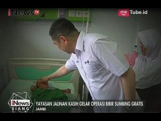 MNC Group Melalui Yayasan Jalinan Kasih Mengadakan Operasi Bibir Sumbing Gratis - iNews Siang 16/05