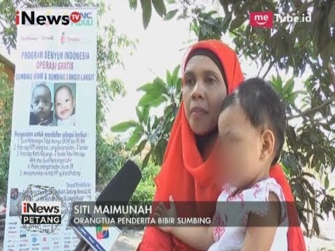 Penderita BIbir Sumbing Mendapatkan Operasi Gratis Dari MNC Group - iNews Petang 31/05