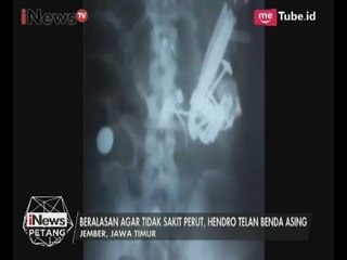 Tak Masuk Akal, Pria Ini Telan Benda Tajam Agar Perut Tidak Sakit - iNews Petang 19/07