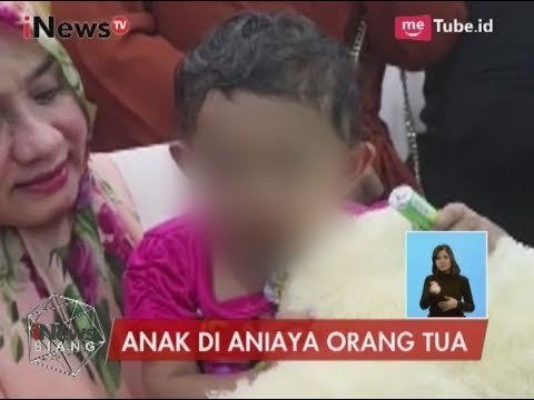 Bocah Malang 2 Tahun Ini Disiksa Orang Tuanya Hingga Kedua Tangannya Patah - iNews Siang 18/08