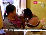 Prihatin, MNC Peduli Bantu Pasutri Tuna Netra yang Memiliki Bayi Bibir Sumbing - iNews Pagi 23/09