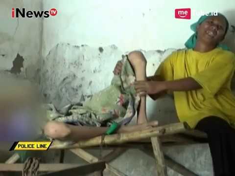 Over Dosis Mengkonsumsi Pil Koplo, Pemuda Ini Dirantai oleh Orangtuanya - Police Line 02/10