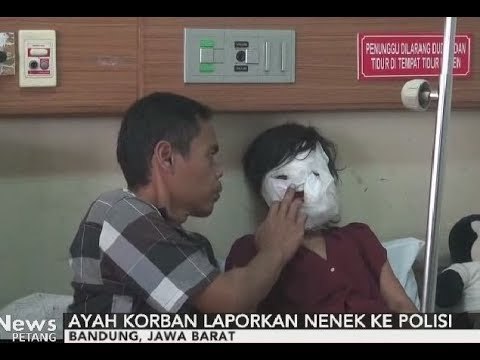 Tragis!! Gadis Ini Dianiaya Neneknya Dengan Mencelupkan Wajah ke Minyak Panas - iNews Petang 10/10