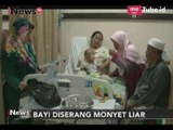 [Naas] Bayi Berumur 9 Bulan Diserang Monyet Liar Hingga Harus Dioperasi - iNews Pagi 13/10