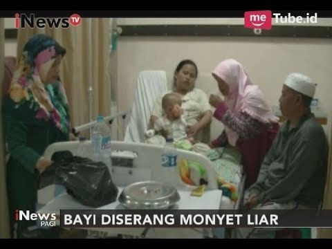 [Naas] Bayi Berumur 9 Bulan Diserang Monyet Liar Hingga Harus Dioperasi - iNews Pagi 13/10