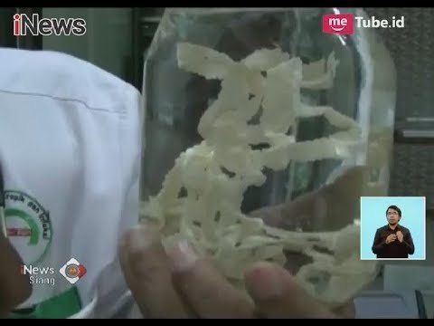 Geger!! Warga Medan Dikejutkan dengan Penemuan Cacing Pita Sepanjang 10,5 Meter - iNews Siang 16/11