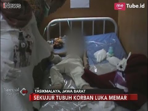 Dianiaya Tante, Balita di Tasikmalaya Dehidrasi Hingga Tak Sadarkan Diri - Special Report 12/01