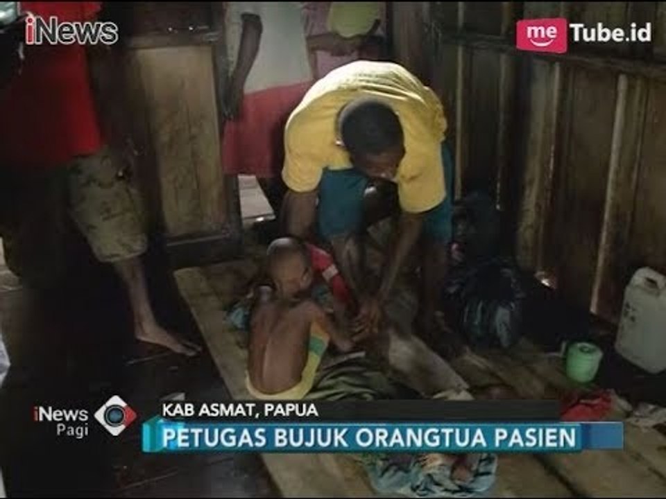 2 Balita Pengidap Campak Kronis Akhirnya Dievakuasi ke RSUD di Kota Agats - iNews Pagi 30/01