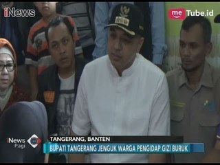 Terindikasi Gizi Buruk, Bupati Tangerang Jenguk Warganya di Krojo - iNews Pagi 29/01