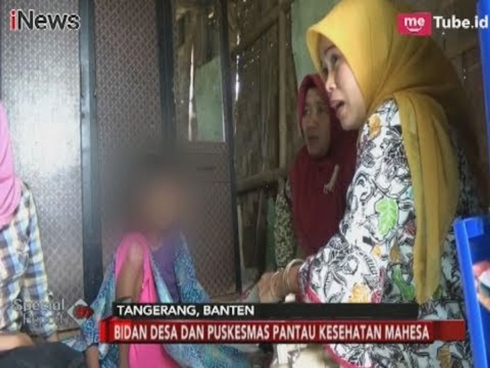 Alami Gizi Buruk, Bocah 13 Tahun di Tangerang Hanya Berbobot 25 Kilogram - Special Report 30/01
