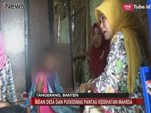 Alami Gizi Buruk, Bocah 13 Tahun di Tangerang Hanya Berbobot 25 Kilogram - Special Report 30/01