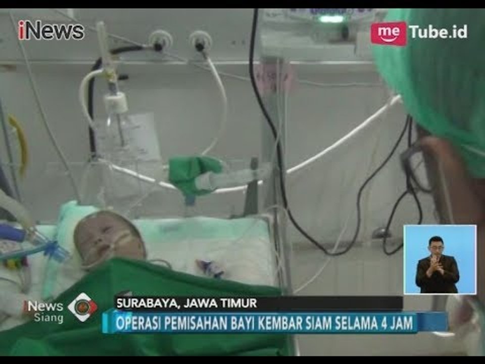 Usai Dioperasi, Bayi Kembar Siam di Surabaya Akhirnya Berhasil Dipisahkan - iNews Siang 01/02