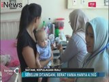 Ironis!! Orang Tua Tak Mampu Beli Susu, Seorang Bayi Alami Gizi Buruk di Batam - iNews Pagi 02/02