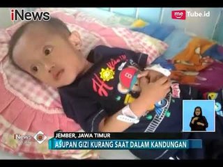 Indonesia Darurat Gizi Buruk Karena Orang Tua Kurang Pengetahuan - iNews Siang 02/02